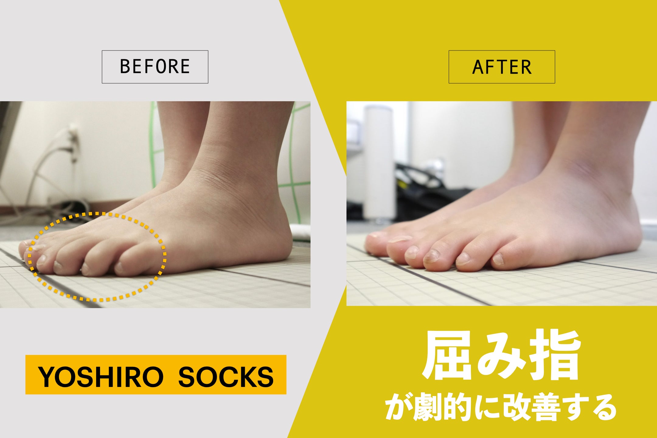 |数量限定 Sサイズ|プラチナグレー|YOSHIRO SOCKS